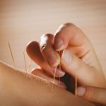 Acupuncture and Cancer Pain Management