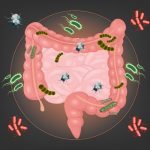 Small Intestine Bacterial Overgrowth: Common but Overlooked Cause of IBS