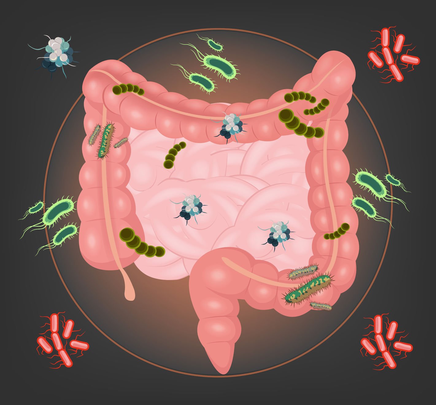 overgrowth of bacteria in gut