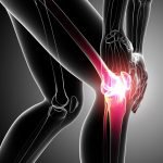 Homeopathic Treatment for Chronic Knee Pain