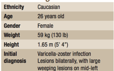 Botanical Treatment of Shingles: A Case Report