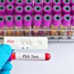 PROSTATE CANCER SCREENING: The PSA Debate Continues—Endgame 2012