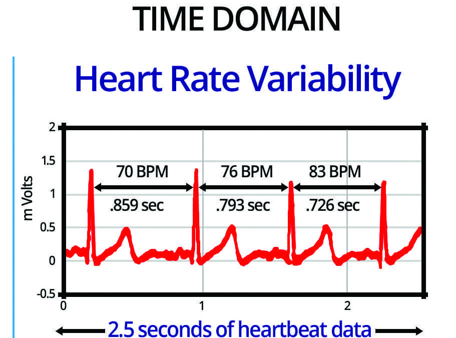 Heart Rate Variability: The Why, What, and How of HRV and Its Importance in Private Practice – Part 1
