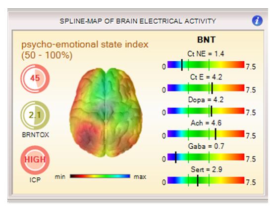 Kessler_Nov_2014_Figure 2_Brain Neurotransmitters