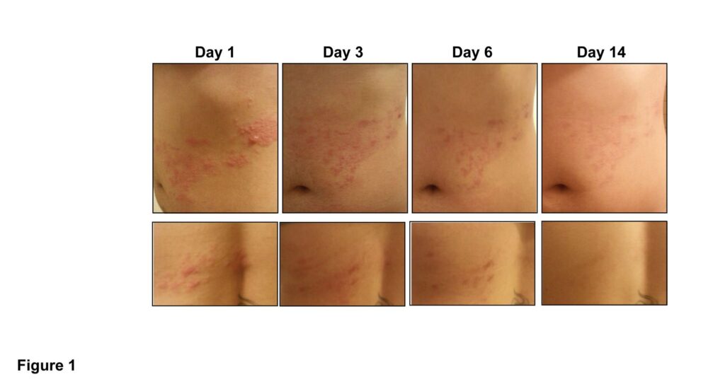 Microsoft PowerPoint - Figure 1