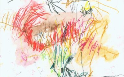 Music as Medicine: A Case Study in Autism