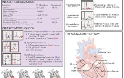 Risk Stratification of CVD: Making Use of an ECG Interpretation Guide