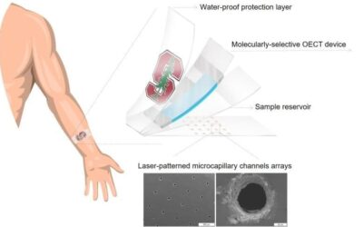 Wearable device from Stanford measures cortisol in sweat