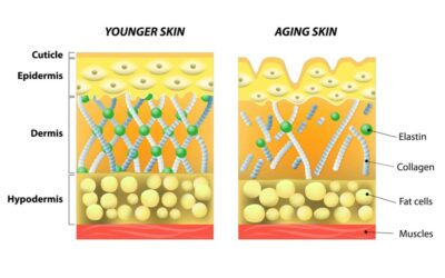 Proteoglycans: A Turnkey Anti-Aging Solution?
