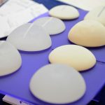 Breast Implants & Autoimmunity: Connecting Silicone Implants with Immune Dysregulation