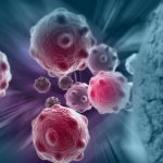 Inflammatory Response to Tumors May Play Bigger Role in Cancer than Previously Thought