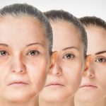 The Skin: An Outer Reflection of Inner Aging