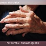 Ayurvedic Interventions for Rheumatoid Arthritis