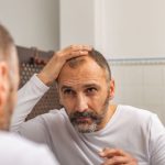 D-Ribose As Effective As Minoxidil in Male Pattern Baldness