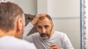 D-Ribose As Effective As Minoxidil in Male Pattern Baldness