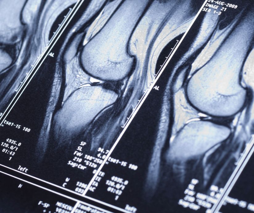 x ray of knee