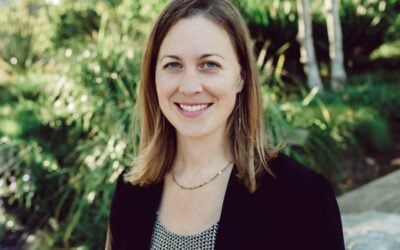 Pseudoangiomatous Stromal Hyperplasia (PASH) of the Breast