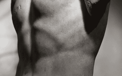 Male Factor Infertility: Naturopathic Case Insights and Lifestyle-Based Interventions to Improve Sperm Health