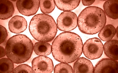 Intravenous Phosphatidylcholine in Severe Refractory Mast Cell Activation Syndrome: A Case Report