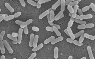 Estrogen Metabolism and the Gut Microbiome: Clinical Strategies for Hormone Detoxification