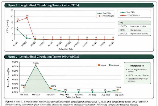 Advanced Inflammatory Breast Cancer: Complete Response with Naturopathic and Immuno-Oncology Treatment